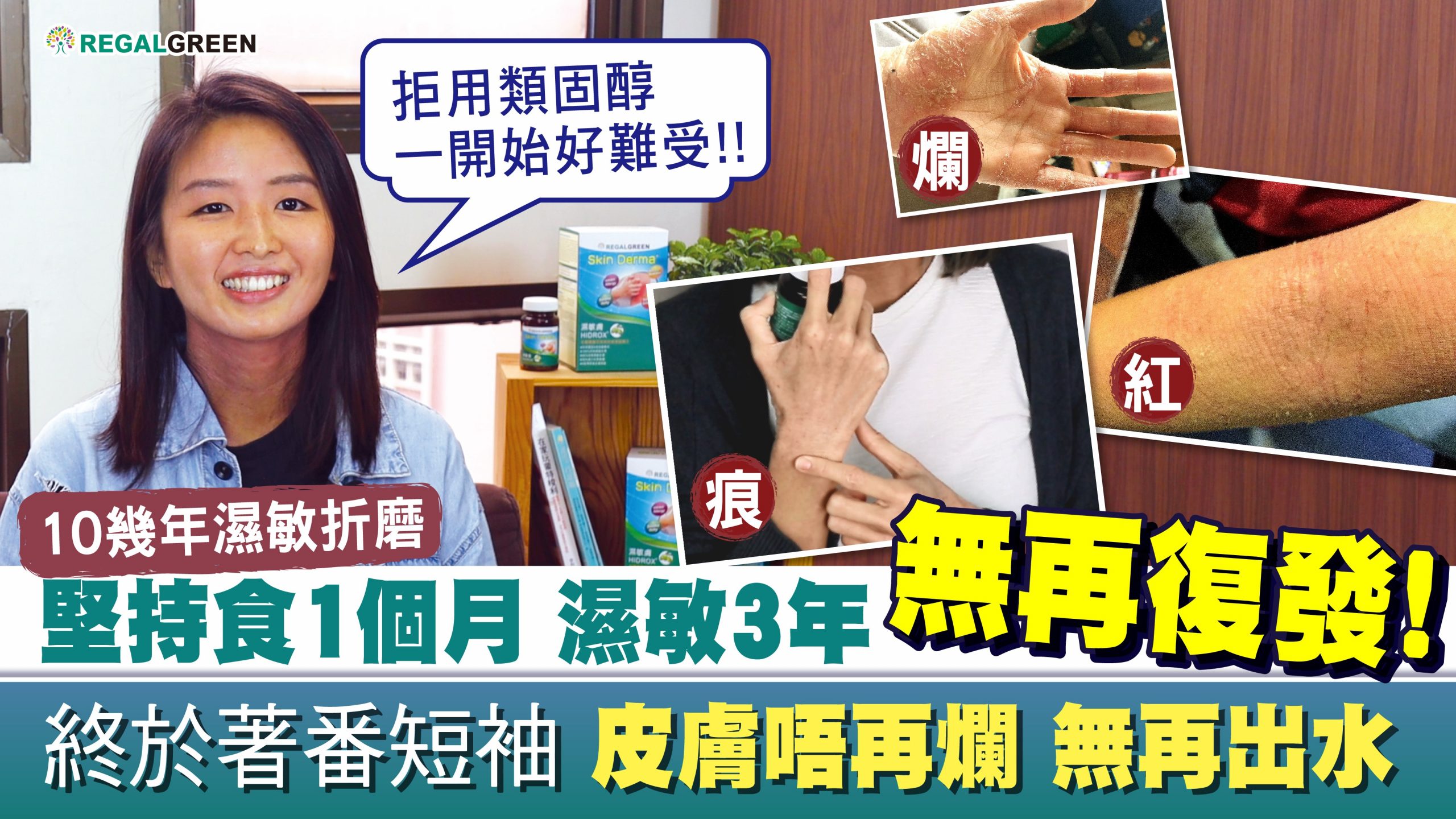 【真實用家成功KO濕敏🥊唔再痕!終於訓到教】