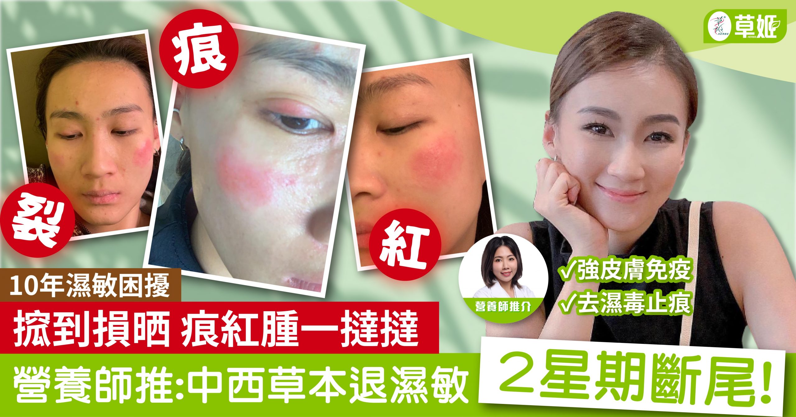 10年濕敏，2星期斷尾!