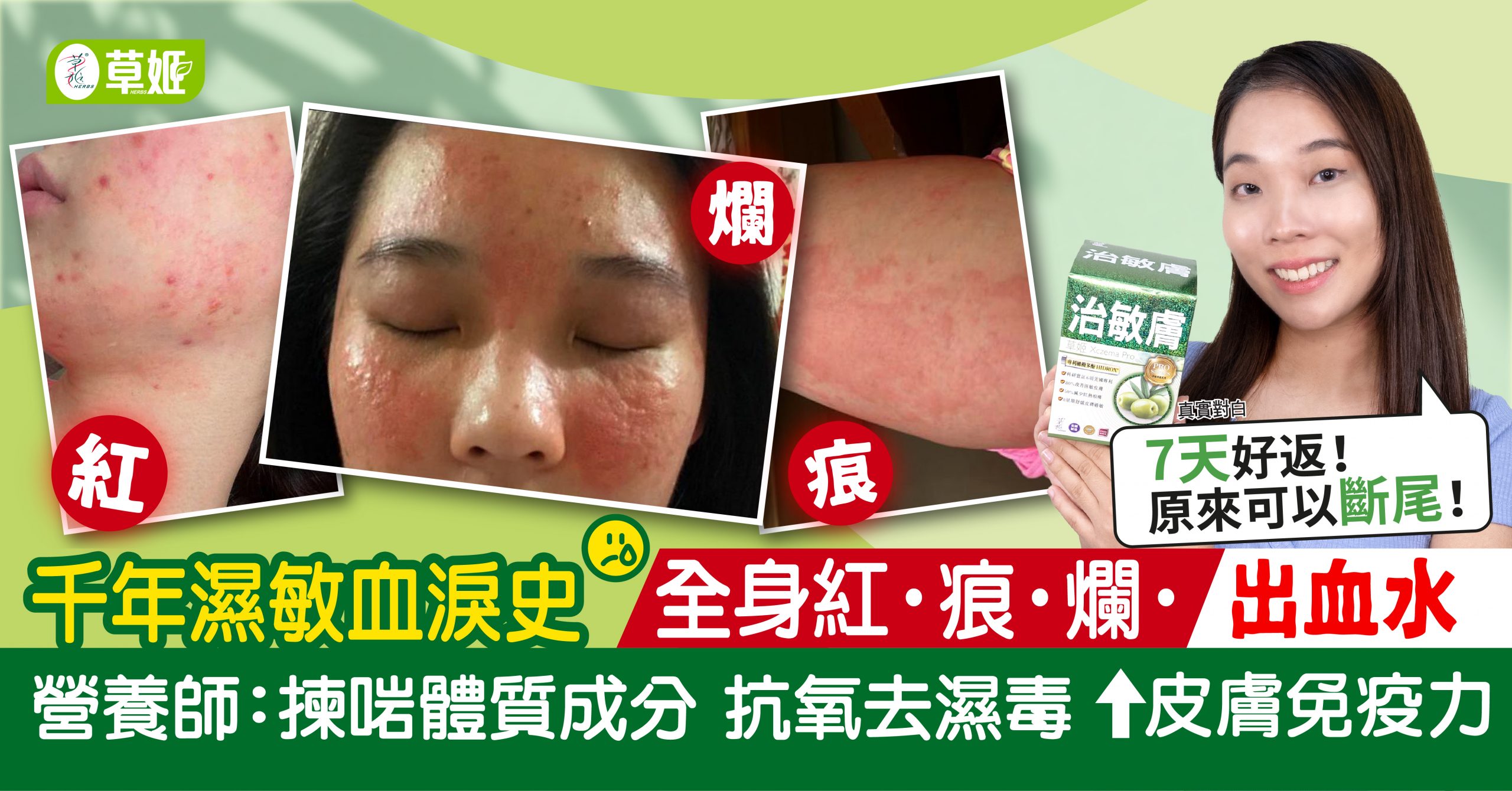 千年濕敏血淚史 紅!痕!爛!出血水!