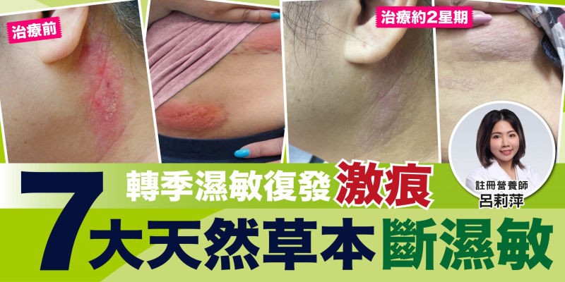 轉季濕敏復發激痕  7大天然草本斷濕敏!