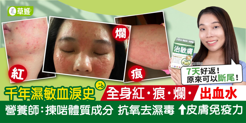 千年濕敏血淚史 紅!痕!爛!出血水!