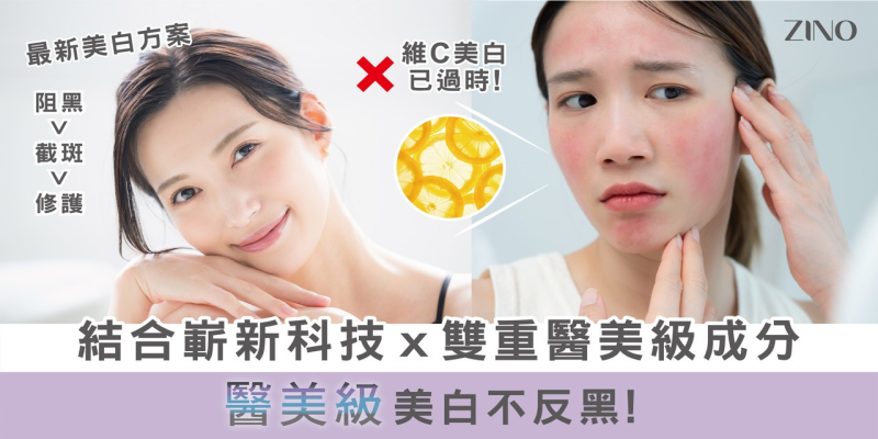 【2026 美白新標準】維 C 已經過時？ZINO 專利美白外泌體：醫美級「阻黑、截斑、修護」3 效合 1，修復肌底不反黑！